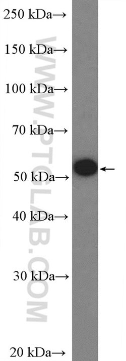 UPF3A Rabbit anti-Human, Polyclonal, Proteintech 150 &mu;L | Buy Online | Proteintech Group Inc | Fisher Scientific