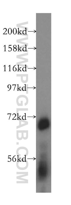 ATP6V1A Rabbit anti-Human, Mouse, Rat, Polyclonal, Proteintech:Antibodies:Primary