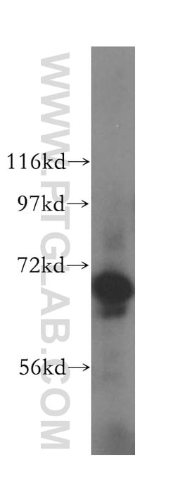 ATP6V1A Rabbit anti-Human, Mouse, Rat, Polyclonal, Proteintech:Antibodies:Primary