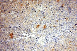ATP6V1A Rabbit anti-Human, Mouse, Rat, Polyclonal, Proteintech:Antibodies:Primary