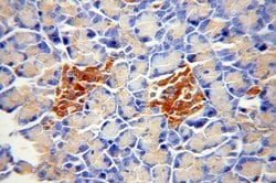 ATP6V1A Rabbit anti-Human, Mouse, Rat, Polyclonal, Proteintech:Antibodies:Primary
