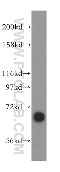 ATP6V1A Rabbit anti-Human, Mouse, Rat, Polyclonal, Proteintech:Antibodies:Primary