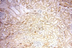 OXCT2 Rabbit anti-Human, Mouse, Rat, Polyclonal, Proteintech 150 &mu;L;