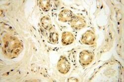 OXCT2 Rabbit anti-Human, Mouse, Rat, Polyclonal, Proteintech 150 &mu;L;