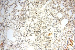OXCT2 Rabbit anti-Human, Mouse, Rat, Polyclonal, Proteintech 150 &mu;L;