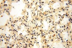 OXCT2 Rabbit anti-Human, Mouse, Rat, Polyclonal, Proteintech 150 &mu;L;