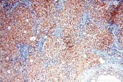OXCT2 Rabbit anti-Human, Mouse, Rat, Polyclonal, Proteintech 150 &mu;L;