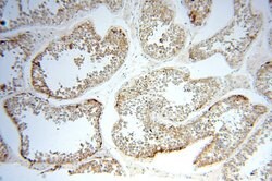 OXCT2 Rabbit anti-Human, Mouse, Rat, Polyclonal, Proteintech 150 &mu;L;