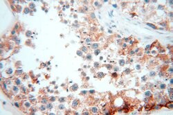 OXCT2 Rabbit anti-Human, Mouse, Rat, Polyclonal, Proteintech 150 &mu;L;