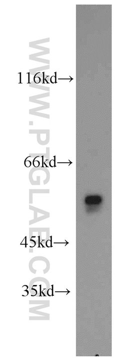 OXCT2 Rabbit anti-Human, Mouse, Rat, Polyclonal, Proteintech 150 &mu;L;