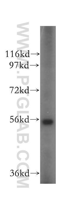 OXCT2 Rabbit anti-Human, Mouse, Rat, Polyclonal, Proteintech 150 &mu;L;