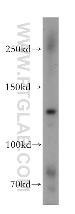 RBM12B Rabbit anti-Human, Mouse, Rat, Polyclonal, Proteintech 150 &mu;L;
