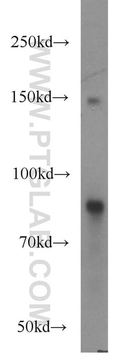 FAM160B2 Rabbit anti-Human, Polyclonal, Proteintech:Antibodies:Primary