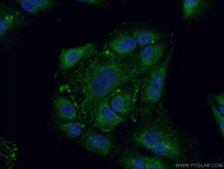 FAM160B2 Rabbit anti-Human, Polyclonal, Proteintech:Antibodies:Primary