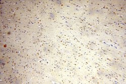 FAM160B2 Rabbit anti-Human, Polyclonal, Proteintech:Antibodies:Primary
