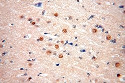 FAM160B2 Rabbit anti-Human, Polyclonal, Proteintech:Antibodies:Primary