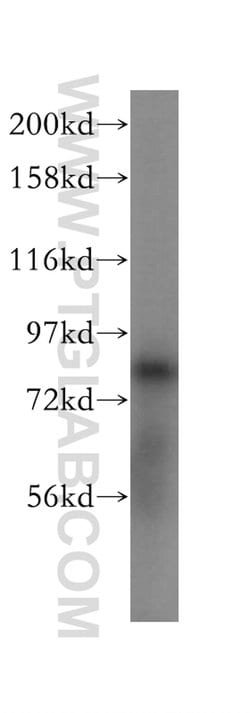 FAM160B2 Rabbit anti-Human, Polyclonal, Proteintech:Antibodies:Primary