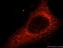 ACAD10 Rabbit anti-Human, Mouse, Rat, Polyclonal, Proteintech 150 &mu;L;