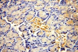 ACAD10 Rabbit anti-Human, Mouse, Rat, Polyclonal, Proteintech 150 &mu;L;