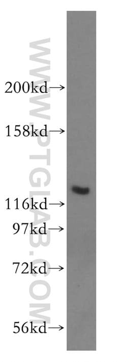 ACAD10 Rabbit anti-Human, Mouse, Rat, Polyclonal, Proteintech 150 &mu;L;