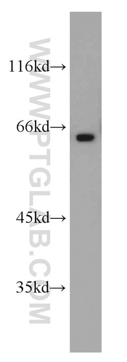 OATP14 Rabbit anti-Human, Mouse, Rat, Polyclonal, Proteintech:Antibodies:Primary