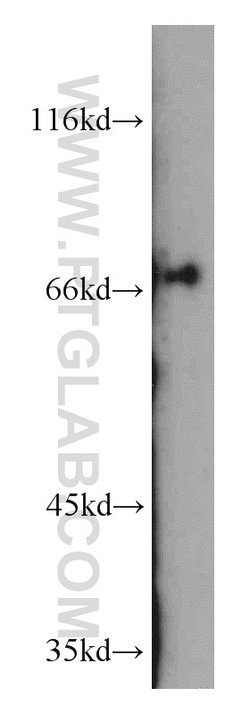 OATP14 Rabbit anti-Human, Mouse, Rat, Polyclonal, Proteintech:Antibodies:Primary