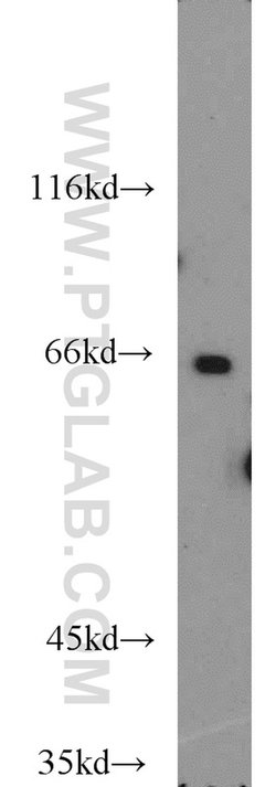 OATP14 Rabbit anti-Human, Mouse, Rat, Polyclonal, Proteintech:Antibodies:Primary