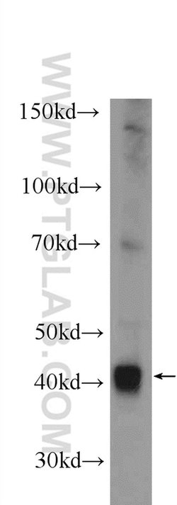 ADH1B Rabbit anti-Human, Mouse, Rat, Polyclonal, Proteintech:Antibodies:Primary