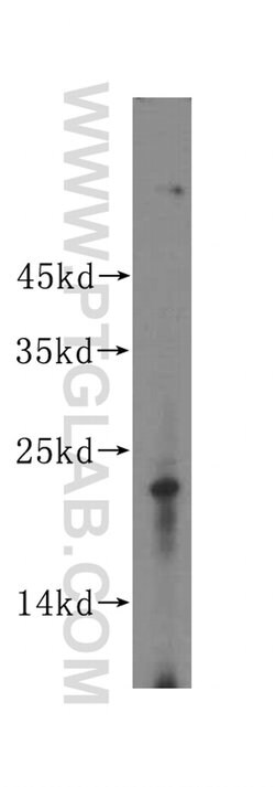 LOH12CR1 Rabbit anti-Human, Mouse, Rat, Polyclonal, Proteintech 150 &mu;L;
