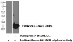 LOH12CR1 Rabbit anti-Human, Mouse, Rat, Polyclonal, Proteintech 150 &mu;L;