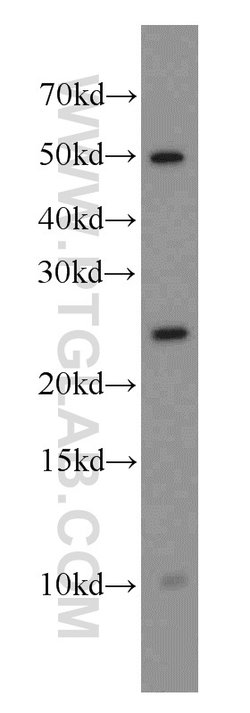 CAPSL Rabbit anti-Human, Mouse, Rat, Polyclonal, Proteintech:Antibodies:Primary