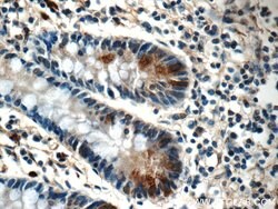 LETM2 Rabbit anti-Human, Polyclonal, Proteintech:Antibodies:Primary Antibodies