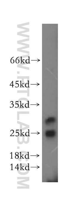 METTL11A Rabbit anti-Human, Mouse, Rat, Polyclonal, Proteintech:Antibodies:Primary