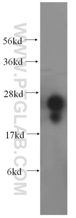METTL11A Rabbit anti-Human, Mouse, Rat, Polyclonal, Proteintech:Antibodies:Primary