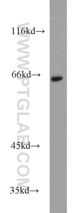CBFA2T3 Rabbit anti-Human, Mouse, Rat, Polyclonal, Proteintech 150 &mu;L;