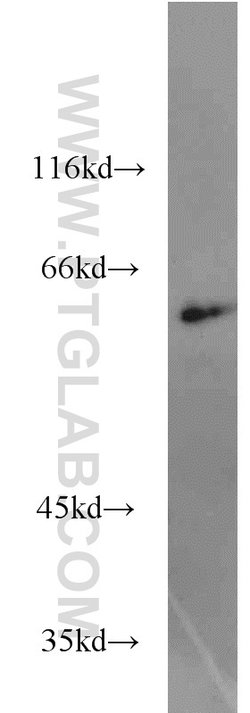 CBFA2T3 Rabbit anti-Human, Mouse, Rat, Polyclonal, Proteintech 150 &mu;L;