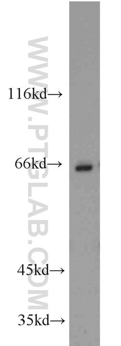 CBFA2T3 Rabbit anti-Human, Mouse, Rat, Polyclonal, Proteintech 150 &mu;L;