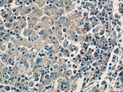 CFP Rabbit anti-Human, Polyclonal, Proteintech 150 &mu;L; Unconjugated:Antibodies,