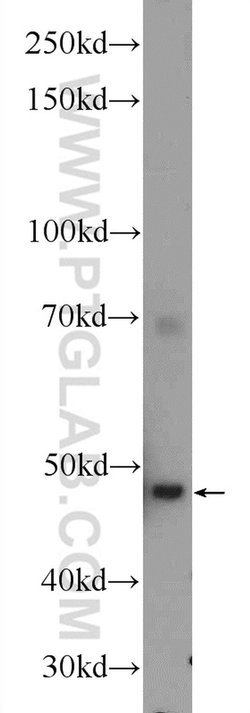 CFP Rabbit anti-Human, Polyclonal, Proteintech 150 &mu;L; Unconjugated:Antibodies,
