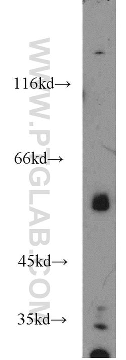 OSBPL2 Rabbit anti-Human, Mouse, Rat, Polyclonal, Proteintech 150 &mu;L;