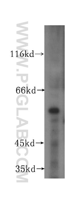 OSBPL2 Rabbit anti-Human, Mouse, Rat, Polyclonal, Proteintech 150 &mu;L;