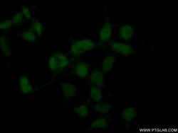RBM11 Rabbit anti-Human, Polyclonal, Proteintech 150 μL; Unconjugated:Antibodies,