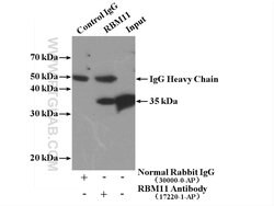 RBM11 Rabbit anti-Human, Polyclonal, Proteintech 150 μL; Unconjugated:Antibodies,