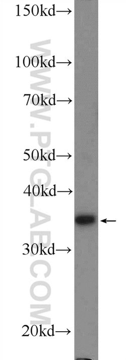 RBM11 Rabbit anti-Human, Polyclonal, Proteintech 150 μL; Unconjugated:Antibodies,