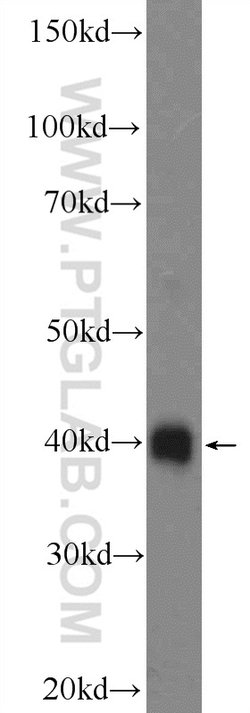 RBM11 Rabbit anti-Human, Polyclonal, Proteintech 150 μL; Unconjugated:Antibodies,