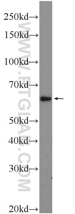 CORO6 Rabbit anti-Human, Mouse, Rat, Polyclonal, Proteintech:Antibodies:Primary