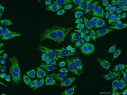 ATPB Rabbit anti-Human, Mouse, Rat, Polyclonal, Proteintech:Antibodies:Primary