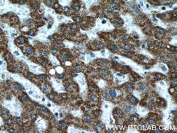 ATPB Rabbit anti-Human, Mouse, Rat, Polyclonal, Proteintech:Antibodies:Primary