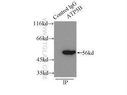 ATPB Rabbit anti-Human, Mouse, Rat, Polyclonal, Proteintech:Antibodies:Primary