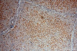 ATPB Rabbit anti-Human, Mouse, Rat, Polyclonal, Proteintech:Antibodies:Primary